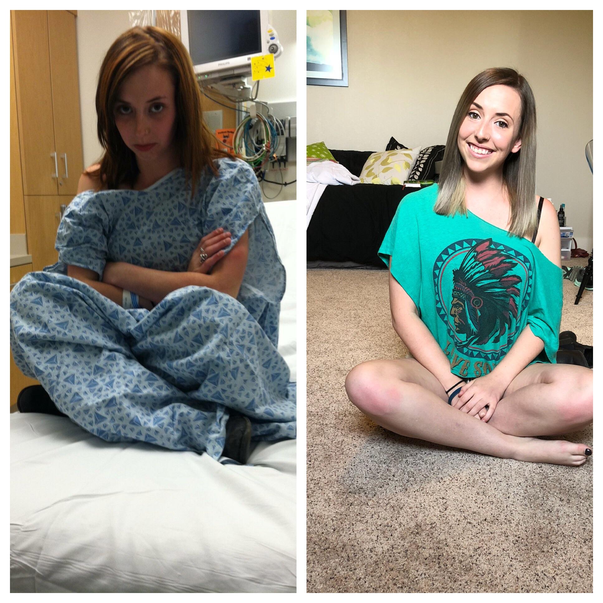 Embracing Your Recovery