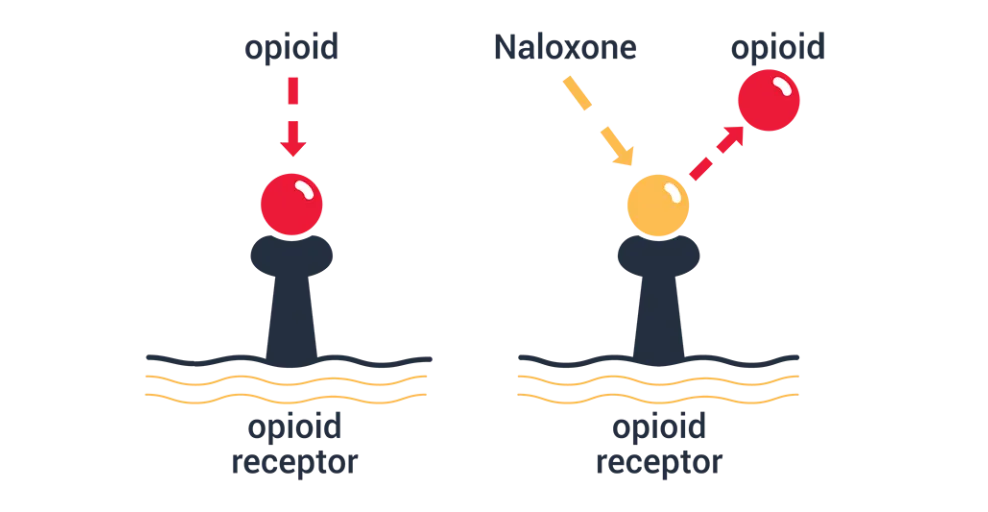 How Naloxone Works
