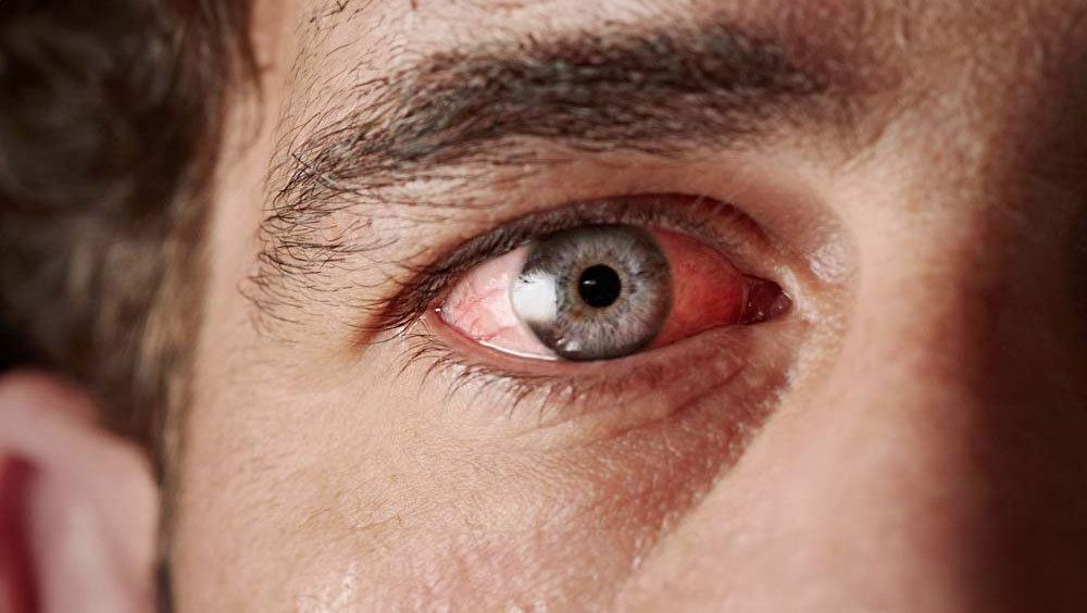 How To Tell When Someone Is High