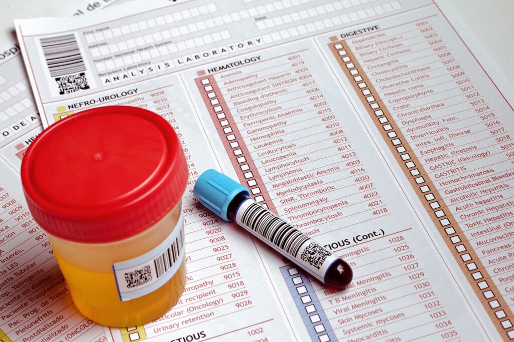 Counteracting Efforts To Cheat Drug Tests
