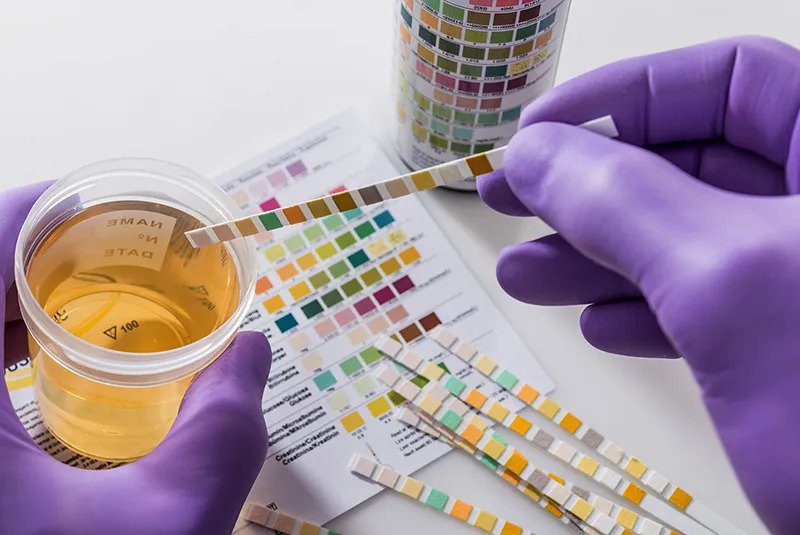 Understanding Urine Drug Tests